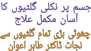 Jisam main gilti ka ilaj in urdu / Hindi | Senay ki gilti ka gharelu ilaj | desi totkay screenshot 1