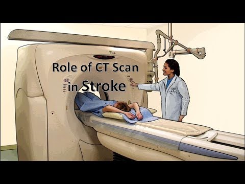Role of CT Scan in Stroke