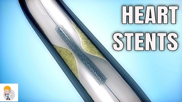 Drug-eluting stents (DES) Vs. Bare metal stents (BMS)