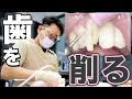 「前歯をセラミックにしたい」前歯を削り、仮歯を作る工程まで全て見せます！(セラミッククラウン / 仮歯 / 大井町 歯医者 / 品川 歯医者)