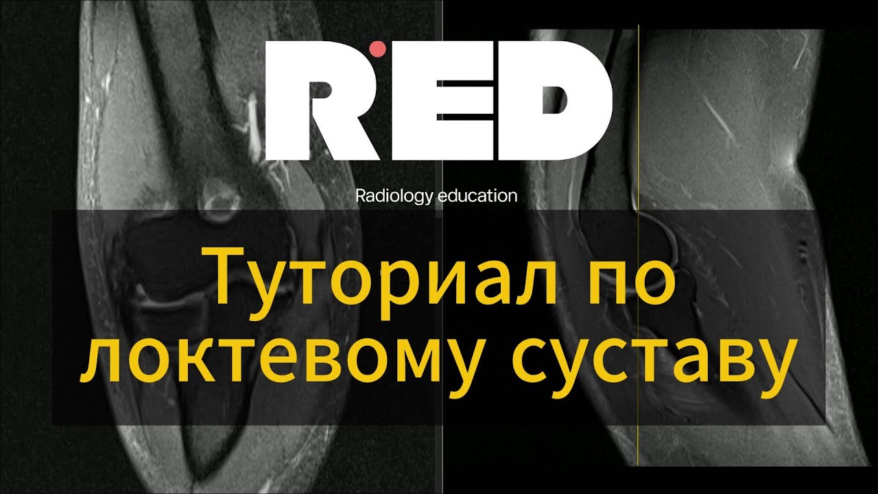 Локтевой сустав на МРТ для начинающих. Туториал