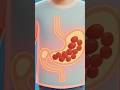 That Stomach Noise? It’s NOT Hunger 😳🔊 #shorts #shortvideo #aishorts