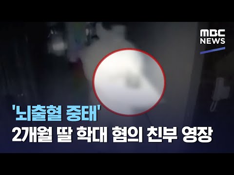 '뇌출혈 중태' 2개월 딸 학대 혐의 친부 영장 (2021.04.14/12MBC뉴스)