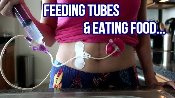 How To: Organize Tube Feeding Supplies – a family of Ohs