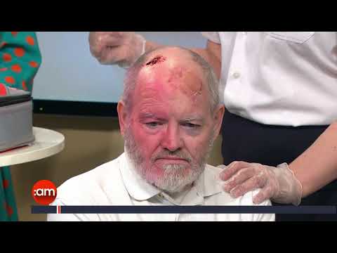 What To Do For A Bleeding Head Injury