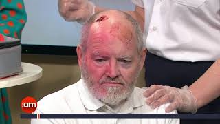 What to do when someone suffers a head injury?