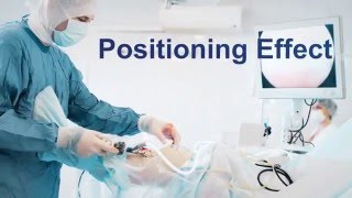 SafeOp EPAD Overview