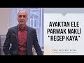 Ayaktan Ele Parmak Nakli "Recep Kaya" - Prof. Dr. Şükrü Yazar