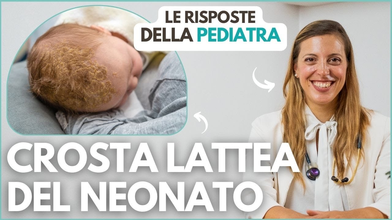 La crosta lattea del neonato: cos'è e come trattarla - GG Giovani Genitori