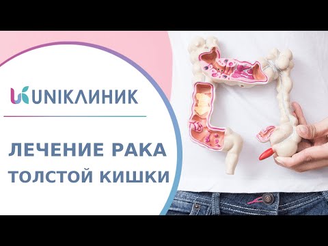 🔎 Рак ободочной кишки: первые симптомы, диагностика, лечение. Лечение рака ободочной кишки. 18+