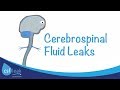 An Introduction to Cerebrospinal Fluid (CSF) Leaks