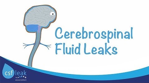 An Introduction to Cerebrospinal Fluid (CSF) Leaks