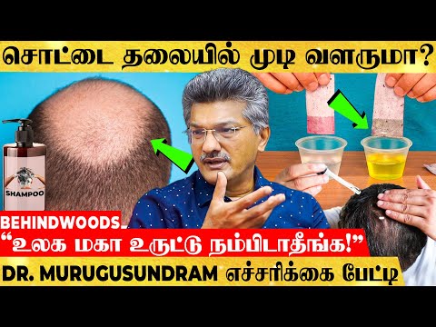 "இது தெரியாம Shampoo Use பண்ணாதீங்க! முடி மொத்தமும் கொட்டிடும்!" DR. MURUGUSUNDRAM பகீர் பேட்டி