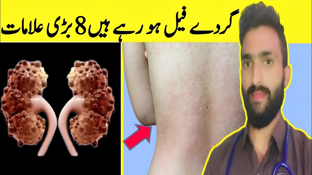 8 Signs Your Kidneys Are Crying for Help | Don’t Ignore These Symptoms 