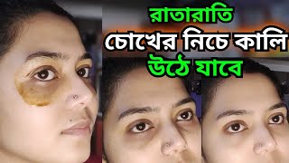 রাতারাতি চোখের নীচের কালো দাগ তুলতে এটা আজই লাগাও/Under eye dark circle/Beauty Highlighting