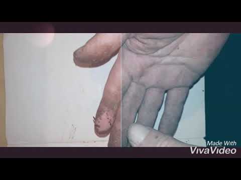 კანაფის ზეთი ხელზე