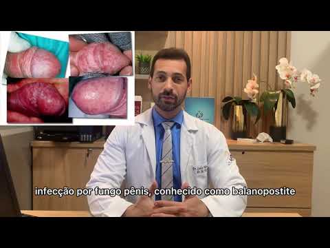 Vídeo: Como prevenir infecções recorrentes de fermento (com fotos)