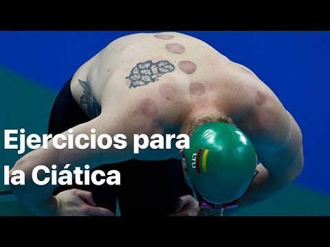 Video: ¿Es bueno nadar para el síndrome del piriforme?