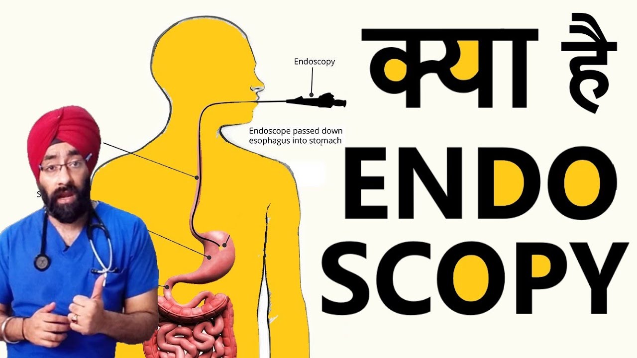 What is Endoscopy Doorbeen ki jaach Dr.Education YouTube