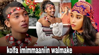 Galaana Jaalalaa:- Ulfaa'uu koo hin barre ture. Doktorri yoo ulfa nan jedhu,ofiin wallaale.