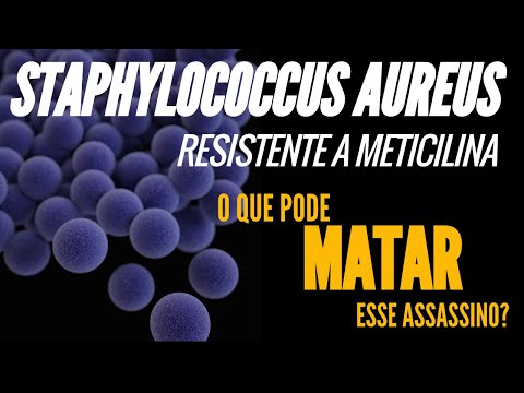 Vídeo: Como é feito o teste mrsa?