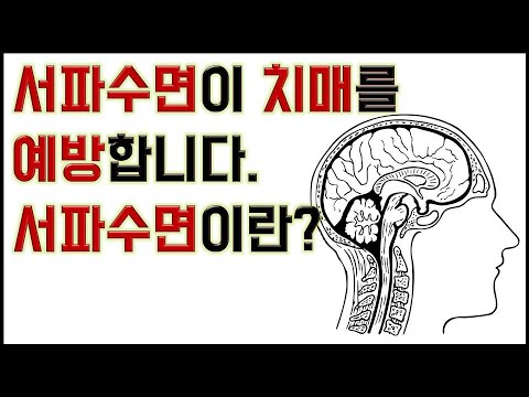 서파수면이 치매를 예방합니다. 서파수면이란 무엇일까요?