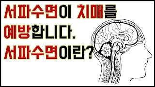 서파수면이 치매를 예방합니다. 서파수면이란 무엇일까요?