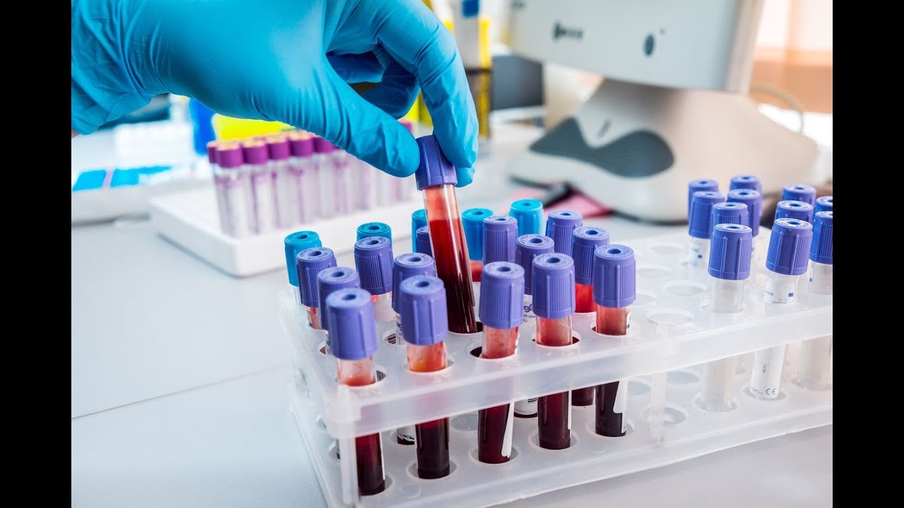 Blood test that could detect 50 types of cancer getting massive trial ...