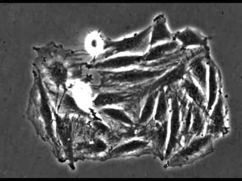 ვიდეო: მიკრობირთვული უჯრედების ზრდა?