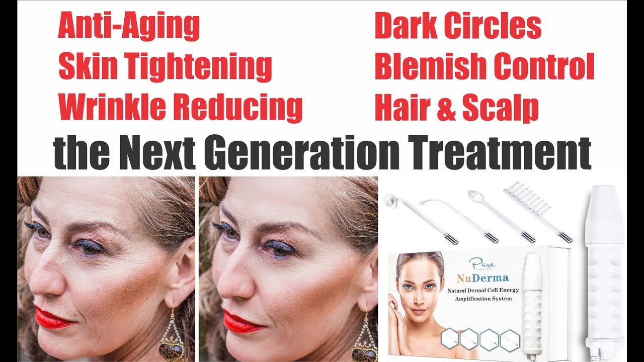 NuDerma Portable Handheld Hi-Frequency Skin Therapy device is a Revolutionary Way to Get Rid of Acne