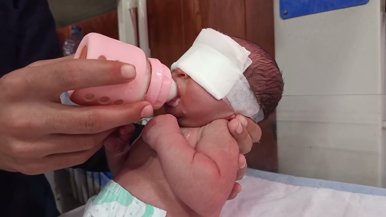 Gentle Bottle Feeding During Neonatal Jaundice Treatment (PT)