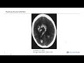 Session 2: Surgical Interventions in Hemorrhagic Stroke: Evidence and Insights