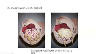 Session 2: Surgical Interventions In Hemorrhagic Stroke: Evidence And Insights