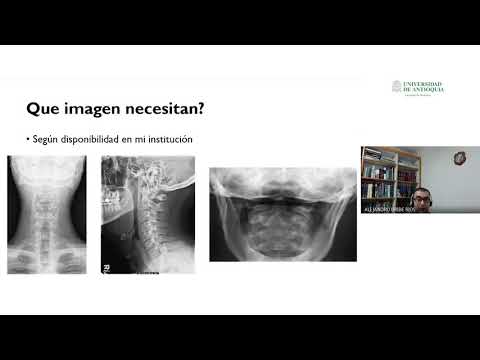 Trauma cervical - Juan Sebastián Sanchez