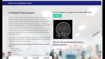 Project For Sale: Brain Tumor Classsification #btech #project #python