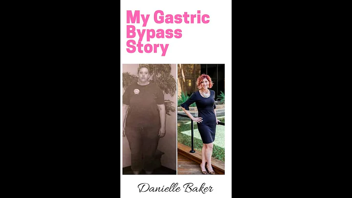 Danielle Baker's Ruin Y Gastric Bypass Story II 5 ...