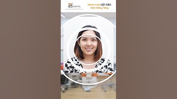 Hành trình LỘT XÁC nhờ niềng răng Thanh Trúc