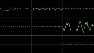 [Sega Genesis/ Mega Drive] Sonic The Hedgehog 3 - Launch Base Zone Act 1 (Beta) (Oscilloscope View)