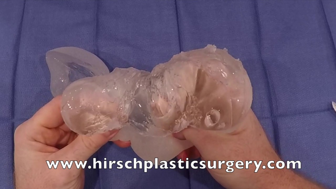 Los Angeles Breast Implants: Gummy Bears 101