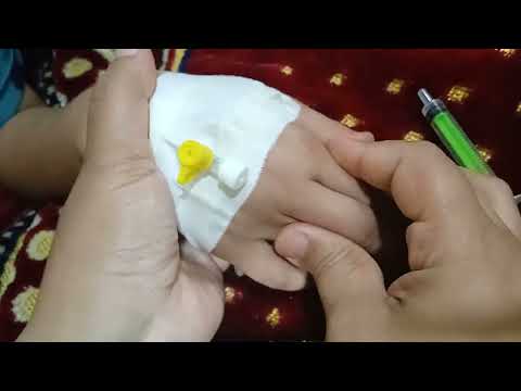 طريقة إعطاء حقنة فى الكانيولا لو فى دم متجلط تحقنه وله تعمل ايه حقنه   
