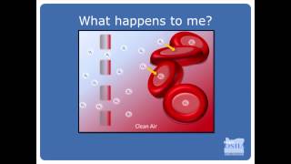 Carbon Monoxide Educational Outreach