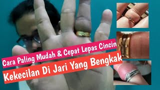 Mudah cepat & tidak sakit melepas cincin di jari yang bengkak|| Tidak usah di kikir tang & gegraji !