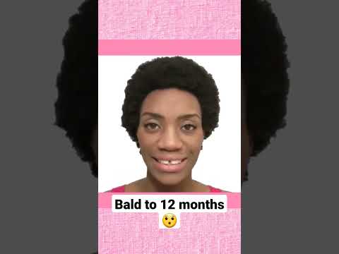 I Shaved All My Hair Off - 2 Year Hair Growth Time Lapse #timelapse #shavingmyhead #hairgrowthshort