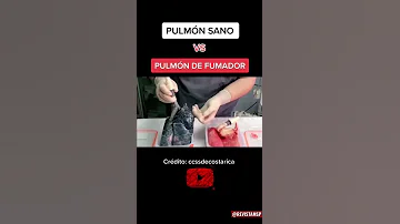 ¿Cómo pueden saber los médicos si fumas?