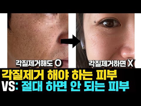 피부 타입별 올바른 각질제거 가이드