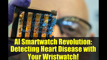 AI Smartwatch Revolution: Detecting Heart Disease with Your Wristwatch!