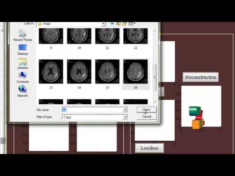 Final Year Projects  | MEDICAL IMAGE COMPRESSION BASED ON REGION OF INTEREST, WITH