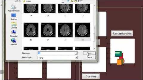 Final Year Projects  | MEDICAL IMAGE COMPRESSION BASED ON REGION OF INTEREST, WITH
