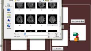 Final Year Projects  | MEDICAL IMAGE COMPRESSION BASED ON REGION OF INTEREST, WITH