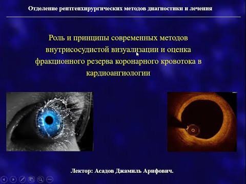 Методы внутрикоронарной визуализации и внутрисосудистого исследования (Асадов Джамиль Арифович)